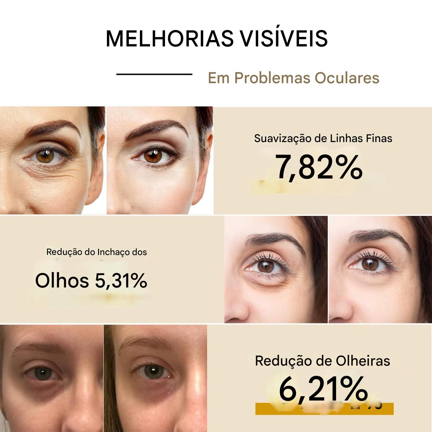 Eye Lift  Pro - CREME REDUTOR DE OLHEIRAS COM BIOATIVO DE CARACOL